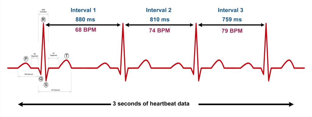 HRV intervals