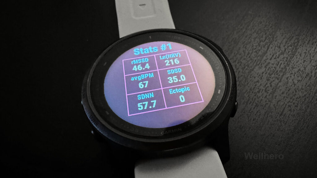 heart rate variability metrics