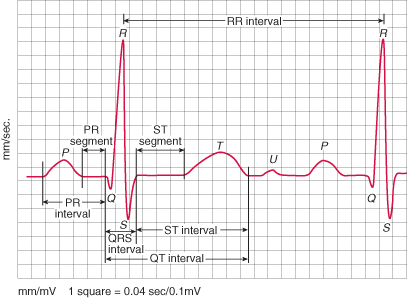RR intervals in HRV