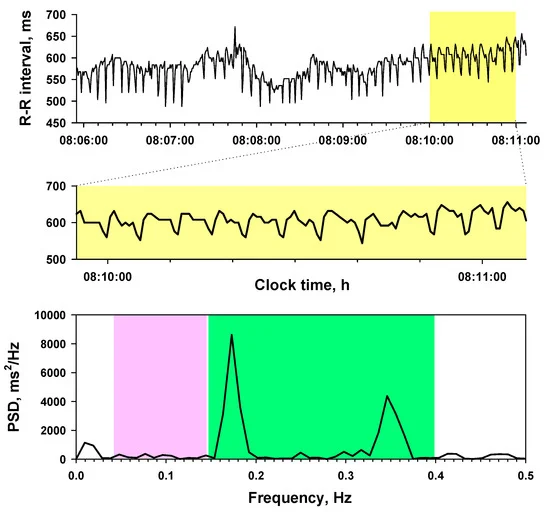 HRV frequency-domain metrics