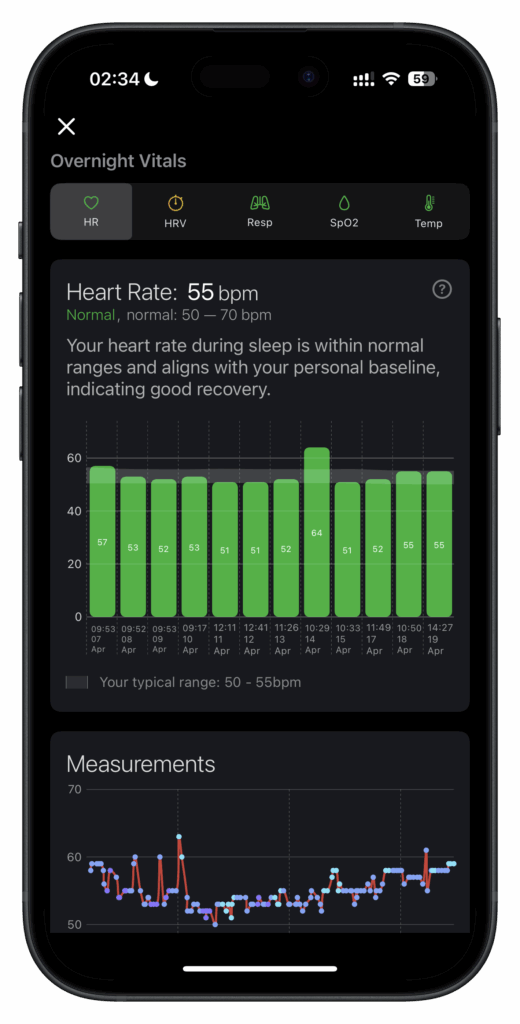 Apple Watch Vitals decoded